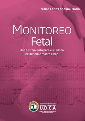 Monitoreo Fetal: Una Herramienta Para El Cuidado Del Binomio Madre - Hijo